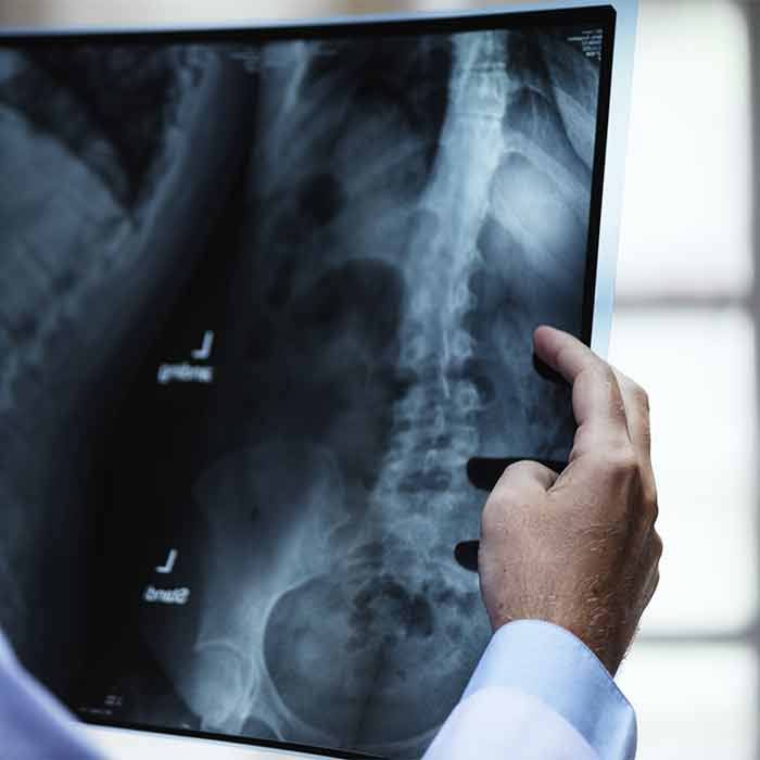 Conseils pour optimiser votre prise en charge ostéopathique